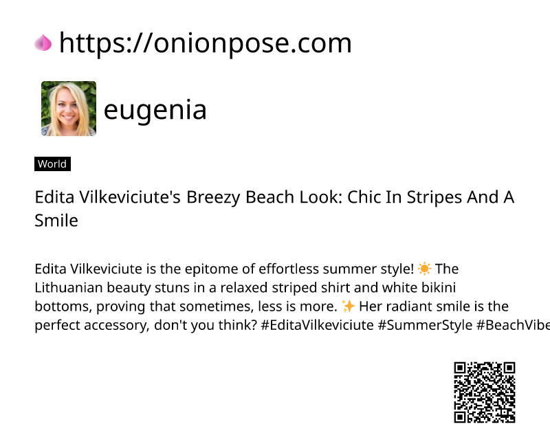 edita-vilkeviciutes-breezy-beach-look-chic-in-stripes-and-a-smile